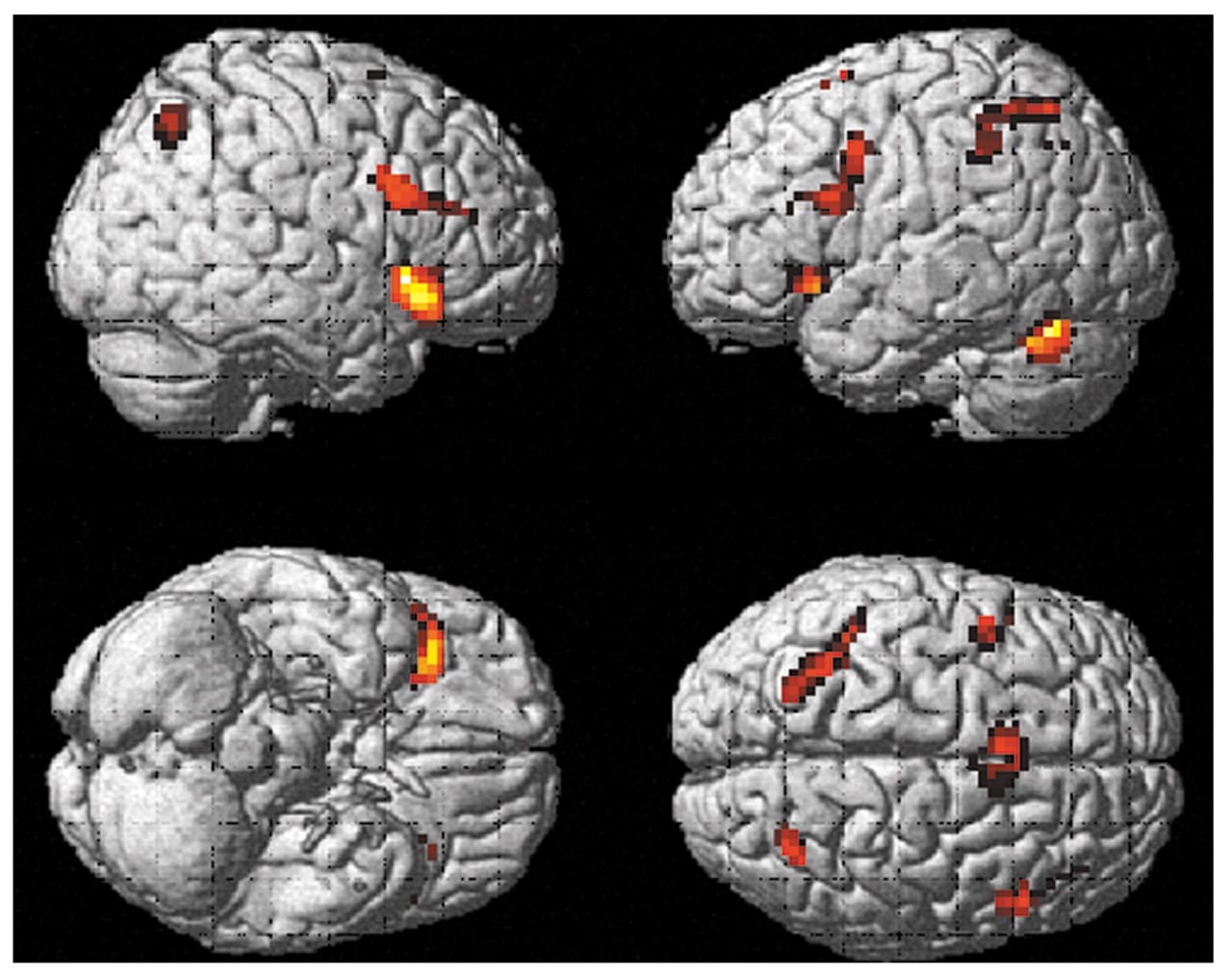 fMRI brain scans showing regions of increased neural activity during mental visualization and cognitive tasks
